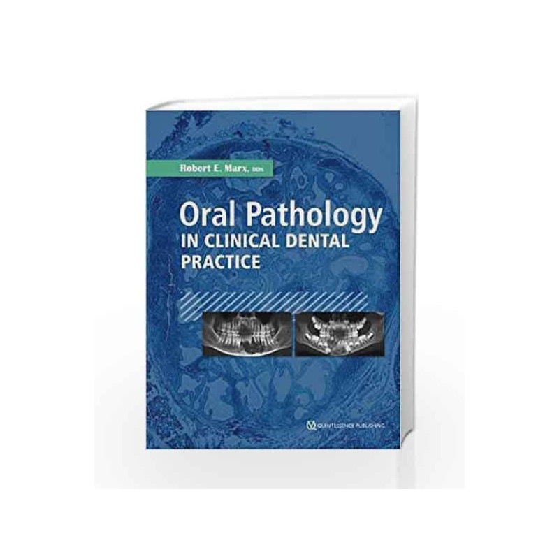 Oral Pathology in Clinical Dental Practice by Marx R E Book-9780867157642