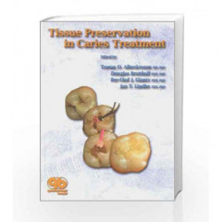 Tissue Preservation in Caries Treatment by Albrektsson Book-9781850970460