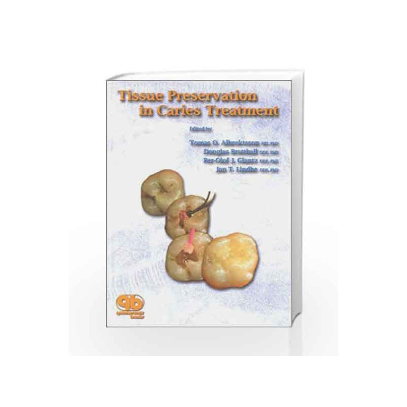 Tissue Preservation in Caries Treatment by Albrektsson Book-9781850970460