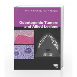 Odontogenic Tumours and Allied Lesions by Reichart Book-9781850970590