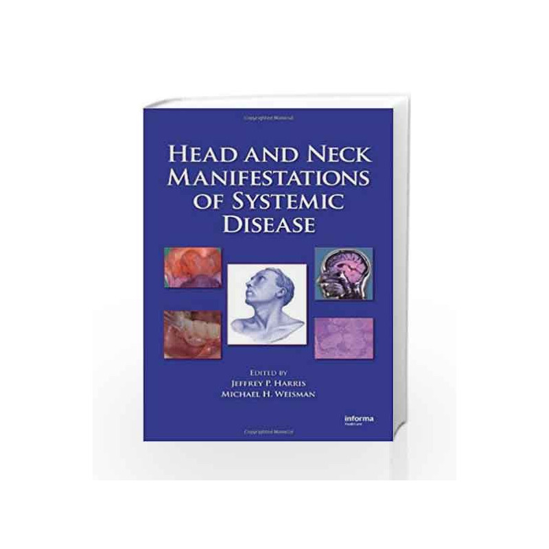 Head and Neck Manifestations of Systemic Disease by Fernandes R. Book-9780849340505