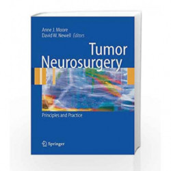 Tumor Neurosurgery: Principles and Practice (Springer Specialist Surgery Series) by Moore A.J. Book-9781846282911
