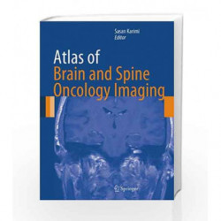 Atlas of Brain and Spine Oncology Imaging (Atlas of Oncology Imaging) by Karimi Book-9781461456520