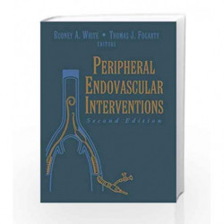 Peripheral Endovascular Interventions by White .R.A. Book-9783540691594