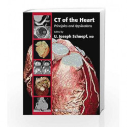 CT of the Heart: Principles and Applications (Contemporary Cardiology) by Schoepf U.J. Book-9781588293039