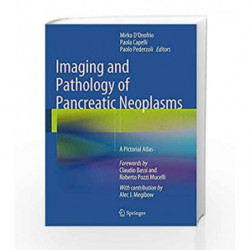 Imaging and Pathology of Pancreatic Neoplasms by Donofrio M Book-9788847056770