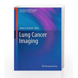 Lung Cancer Imaging (Contemporary Medical Imaging) by Ravenel J.G. Book-9781607616191