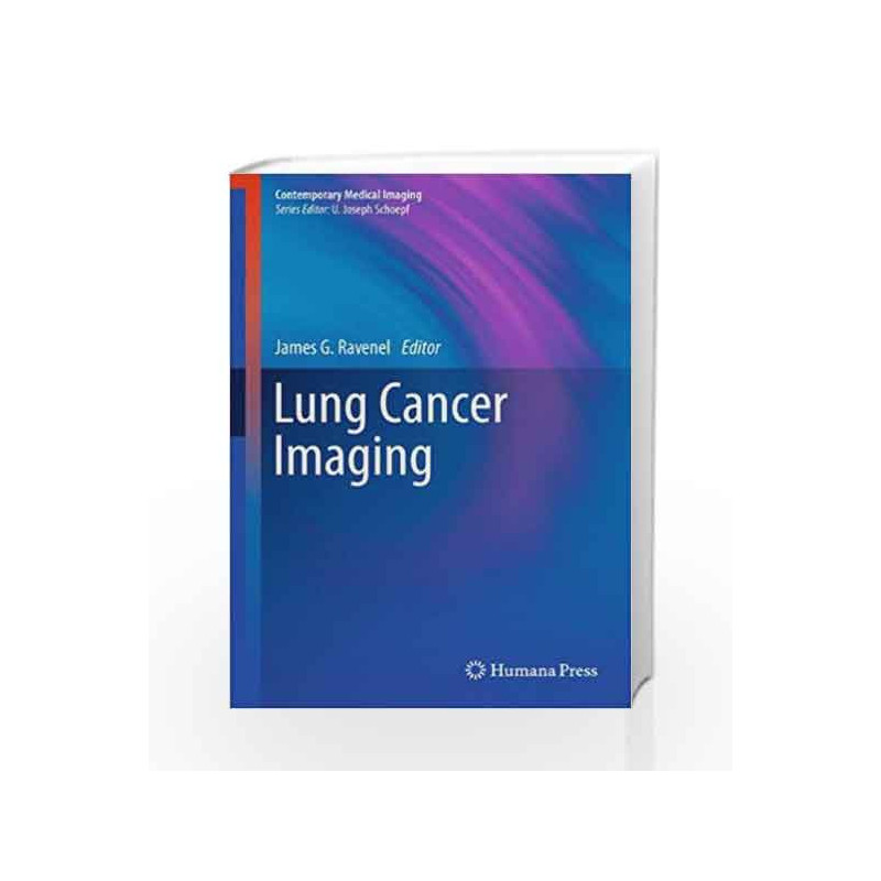 Lung Cancer Imaging (Contemporary Medical Imaging) by Ravenel J.G. Book-9781607616191