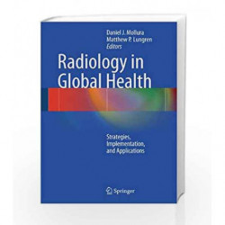 Radiology in Global Health: Strategies, Implementation, and Applications by Mollura D J Book-9781461406037