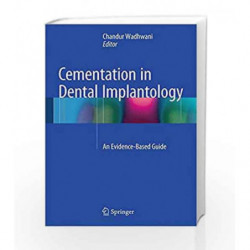 Cementation in Dental Implantology by Wadhwani C P K Book-9783642551628