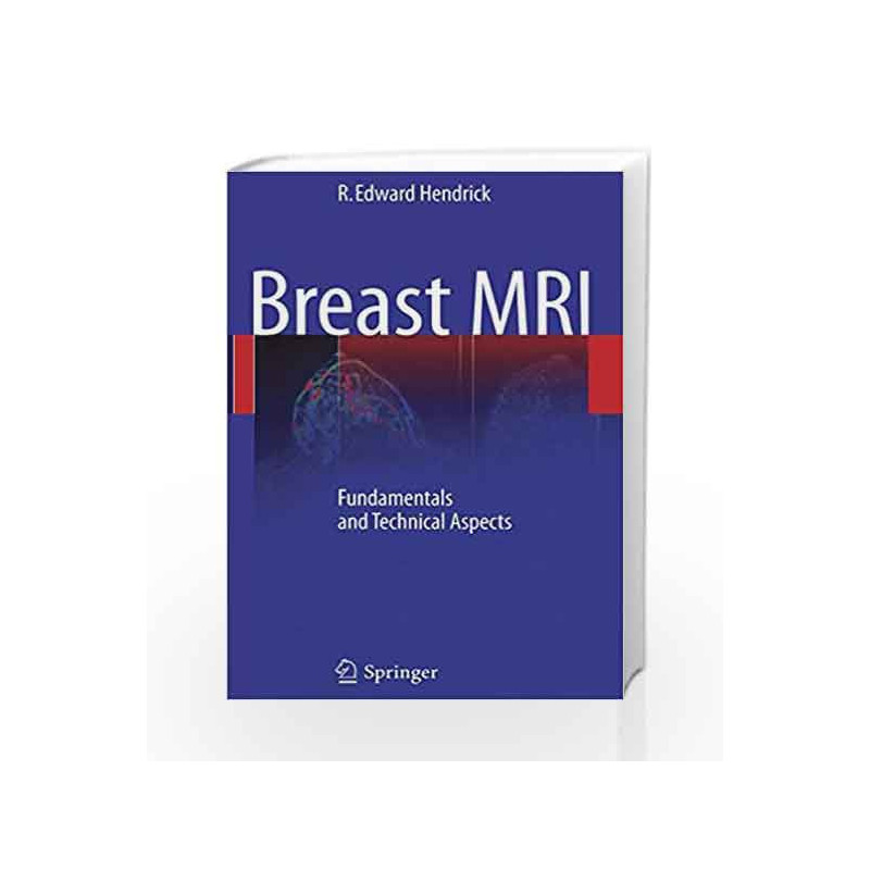 Breast MRI: Fundamentals and Technical Aspects by Hendrick R.E. Book-9781441965202
