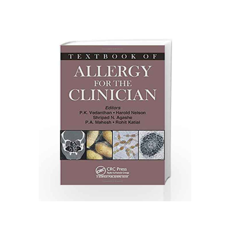 Textbook of Allergy for the Clinician by Vedanthan Book-9781466598331
