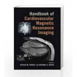 Handbook of Cardiovascular Magnetic Resonance Imaging (Fundamental and Clinical Cardiology) by Pohost Gm Book-9780824758417