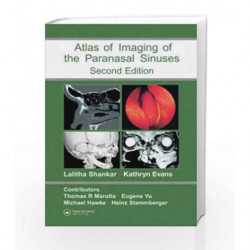 Atlas of Imaging of the Paranasal Sinuses, Second Edition by Shankar Book-9781841844480