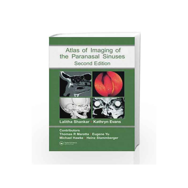 Atlas of Imaging of the Paranasal Sinuses, Second Edition by Shankar Book-9781841844480