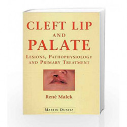 Cleft Lip and Palate: Lesions, Pathophysiology and Primary Treatment by Malek R. Taylor Book-9781853174919