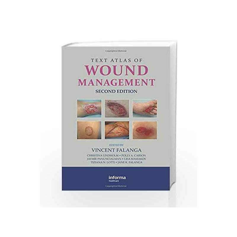 Text Atlas of Wound Management by Falanga V. Book-9780415468657