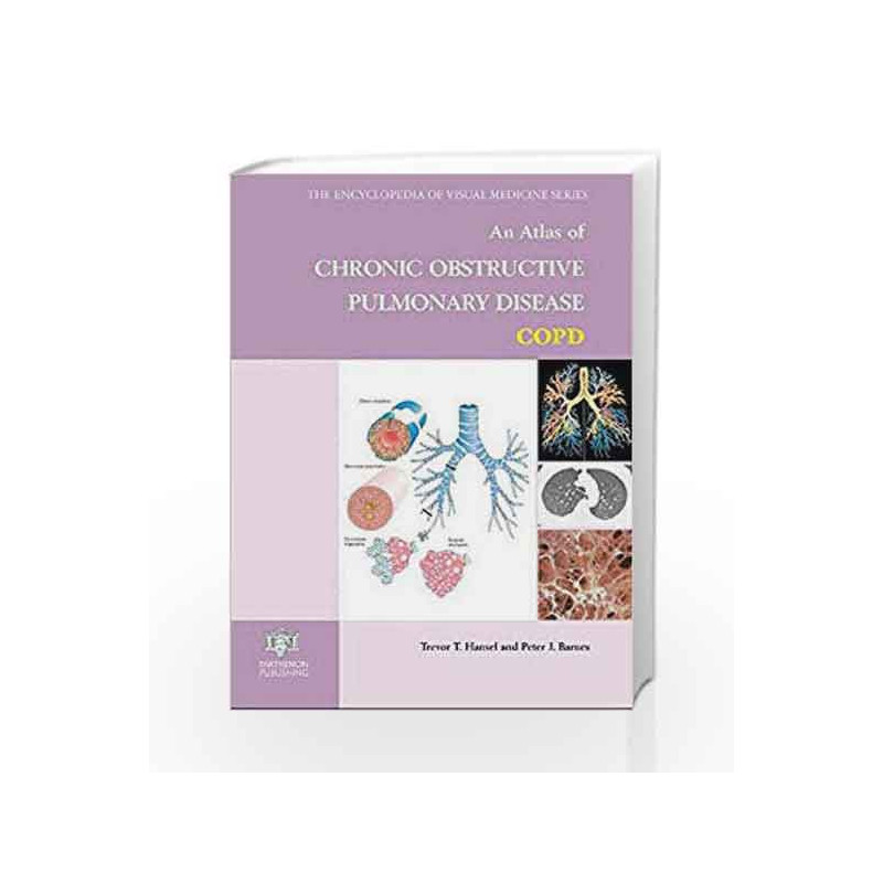 An Atlas of Chronic Obstructive Pulmonary Disease (Encyclopedia of Visual Medicine Series) by Hansel T.T. Book-9781842140048