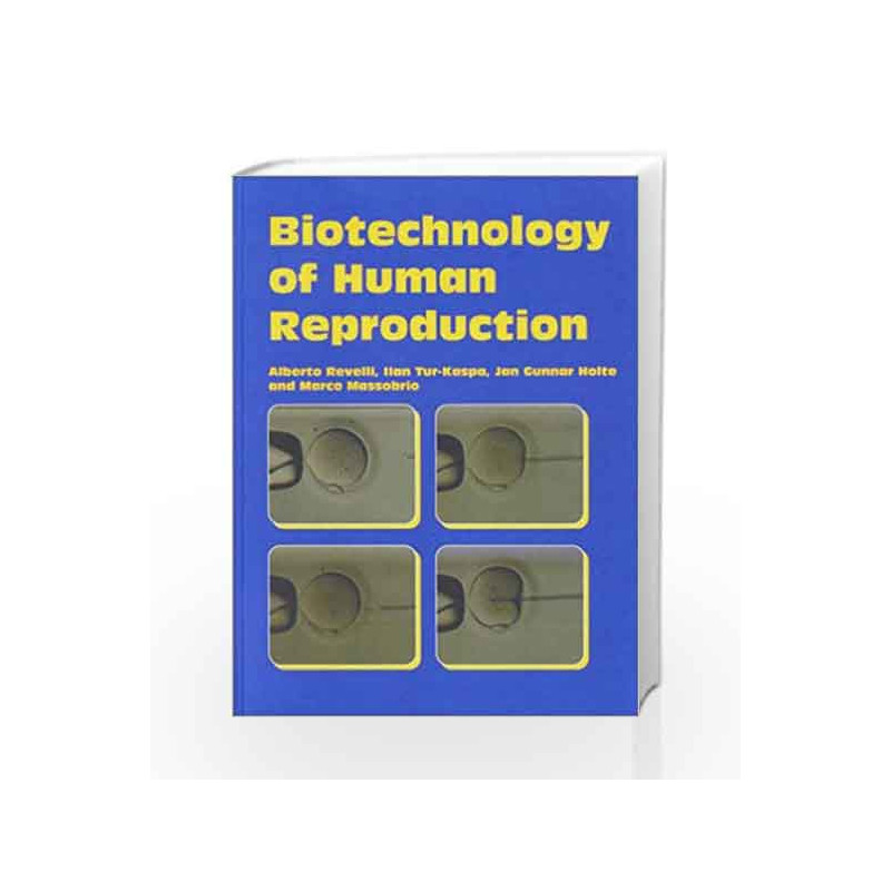 Biotechnology of Human Reproduction by Revelli Alberto Book-9781842141328