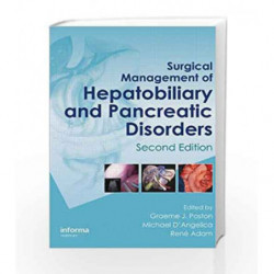 Surgical Management of Hepatobiliary and Pancreatic Disorders, Second Edition (Oncologysurgery) by Poston G.J. Book-978184184693