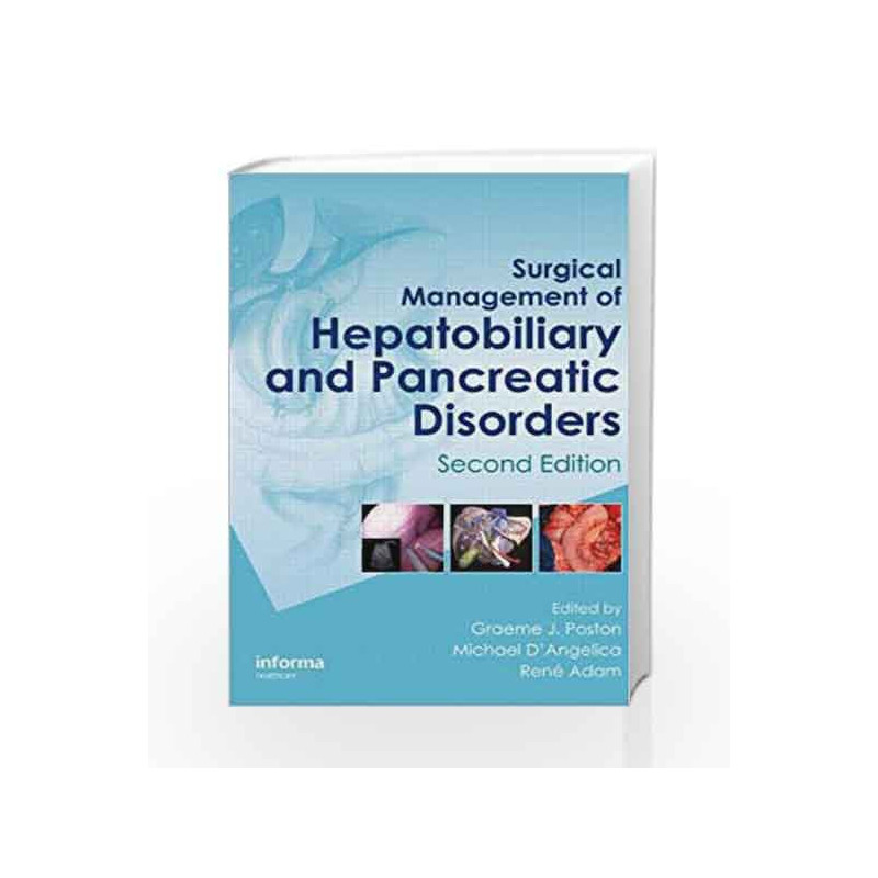 Surgical Management of Hepatobiliary and Pancreatic Disorders, Second Edition (Oncologysurgery) by Poston G.J. Book-978184184693
