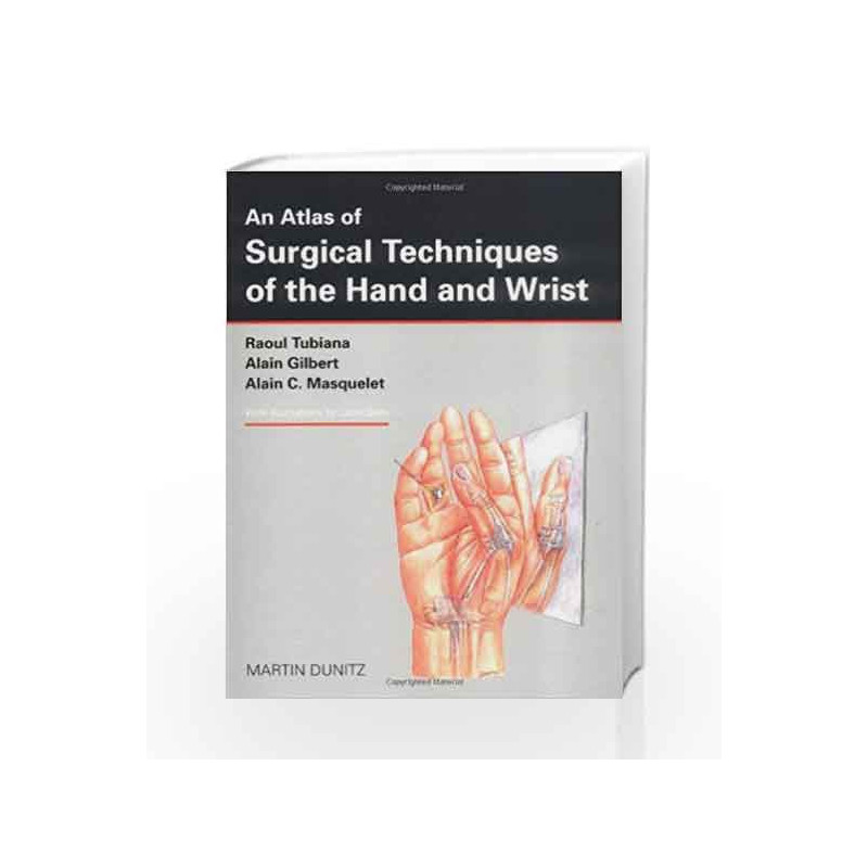 An Atlas of Surgical Techniques of the Hand and Wrist by Tubiana R. Book-9781853173004