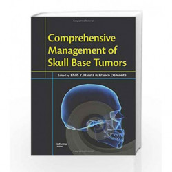 Comprehensive Management of Skull Base Tumors by Hanna E.Y. Book-9780849340543