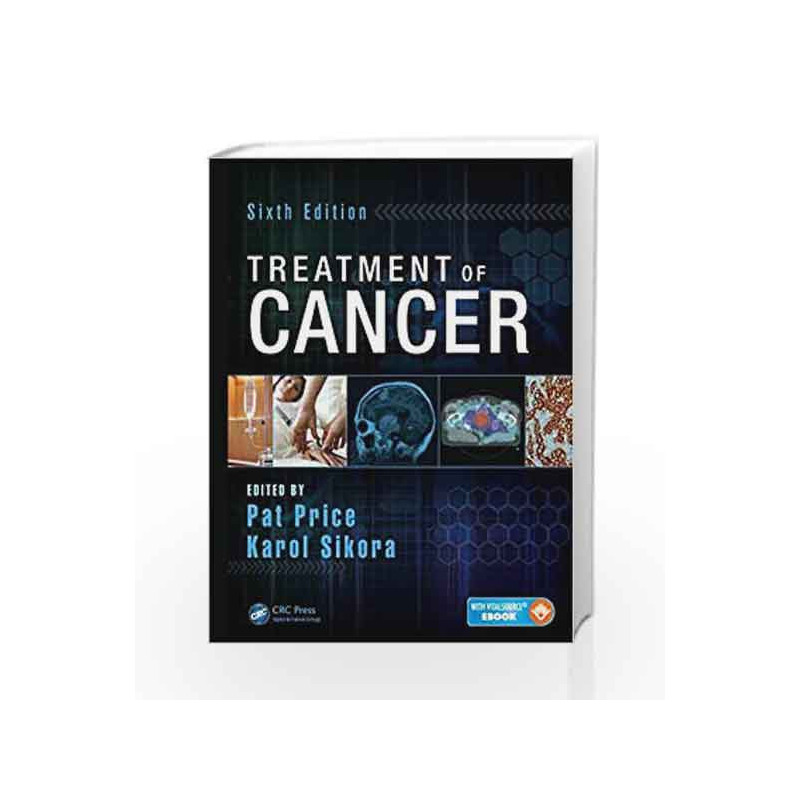 Treatment of Cancer by Price Book-9781482214949