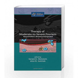 Therapy of Moderate-to-Severe-Psoriasis, Second Edition by Salunkhe D.K. Book-9780824701055