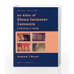 An Atlas of Glass-Ionomer Cements: A Clinician's Guide by Mount G.J. Book-9781841840697