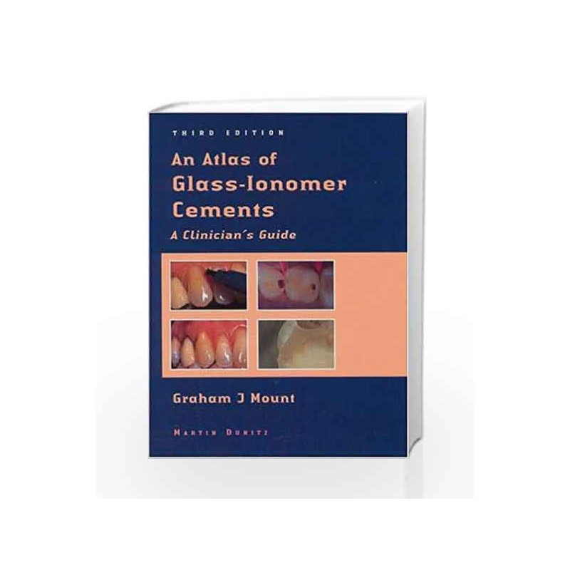 An Atlas of Glass-Ionomer Cements: A Clinician's Guide by Mount G.J. Book-9781841840697