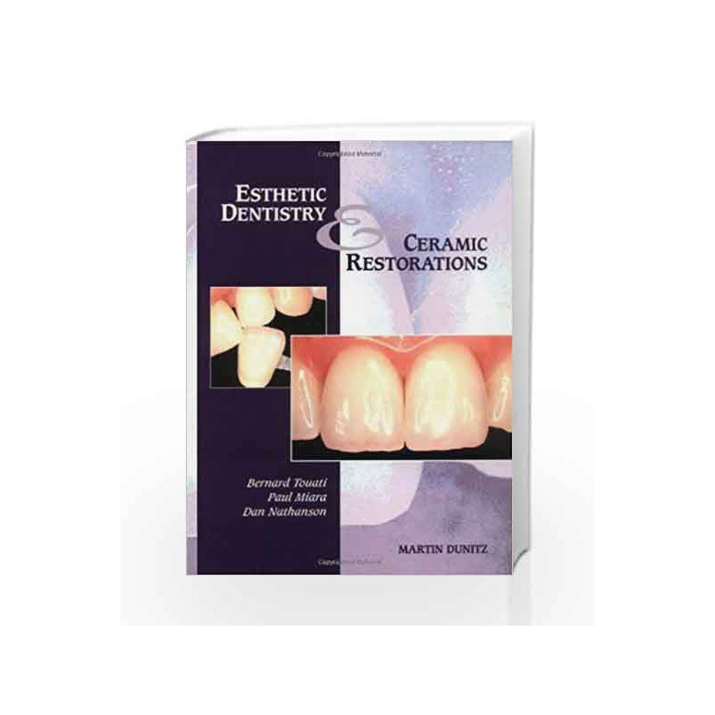 Esthetic Dentistry and Ceramic Restorations by Touati B. Book-9781853171598