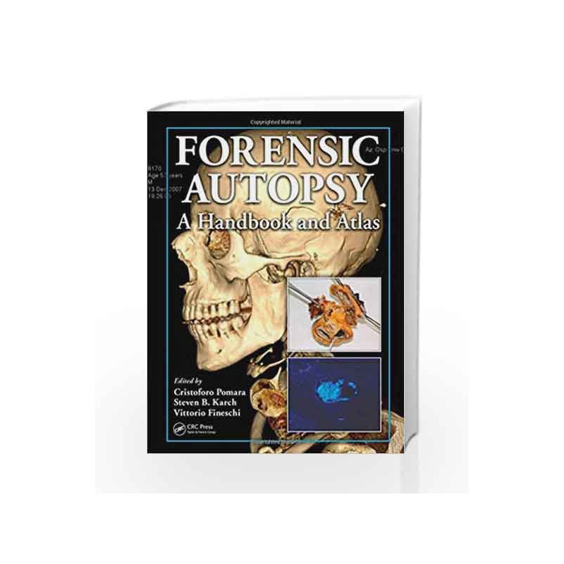 Forensic Autopsy: A Handbook and Atlas by Pomara Book-9781439800645