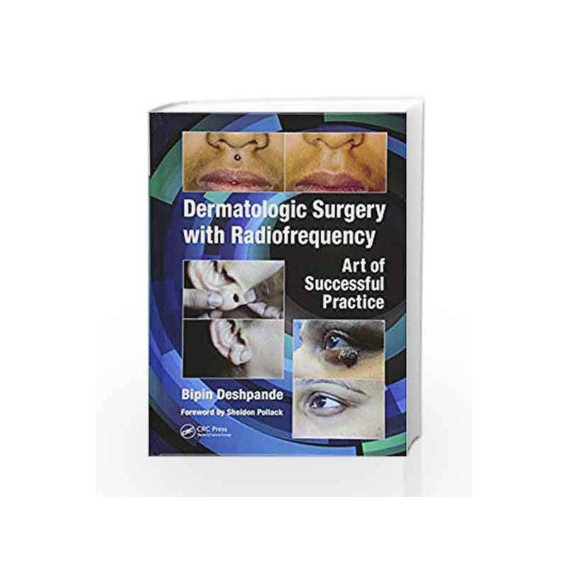 Dermatologic Surgery with Radiofrequency: Art of Successful Practice by Deshpande B Book-9781138301146