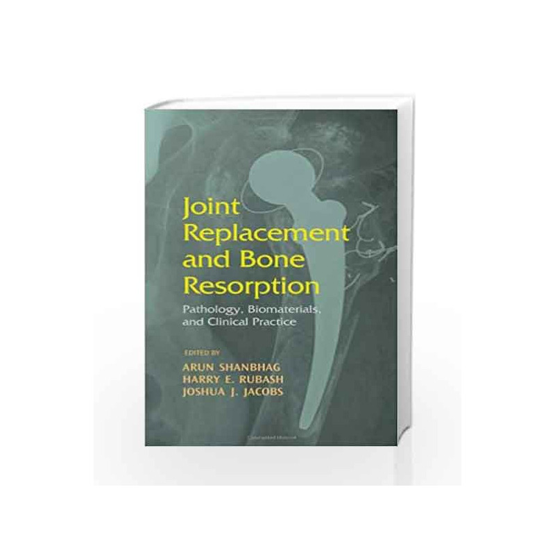 Joint Replacement and Bone Resorption: Pathology, Biomaterials and Clinical Practice by Rai M.K. Book-9781578087938