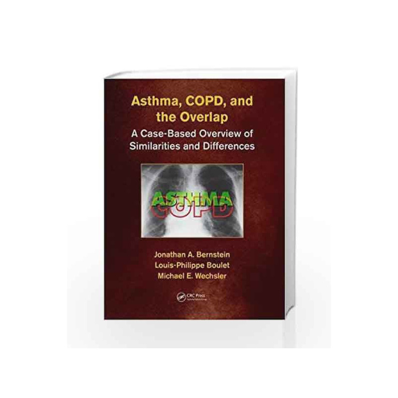 Asthma, COPD, and Overlap: A Case-Based Overview of Similarities and Differences by Bernstein J A Book-9781498758413