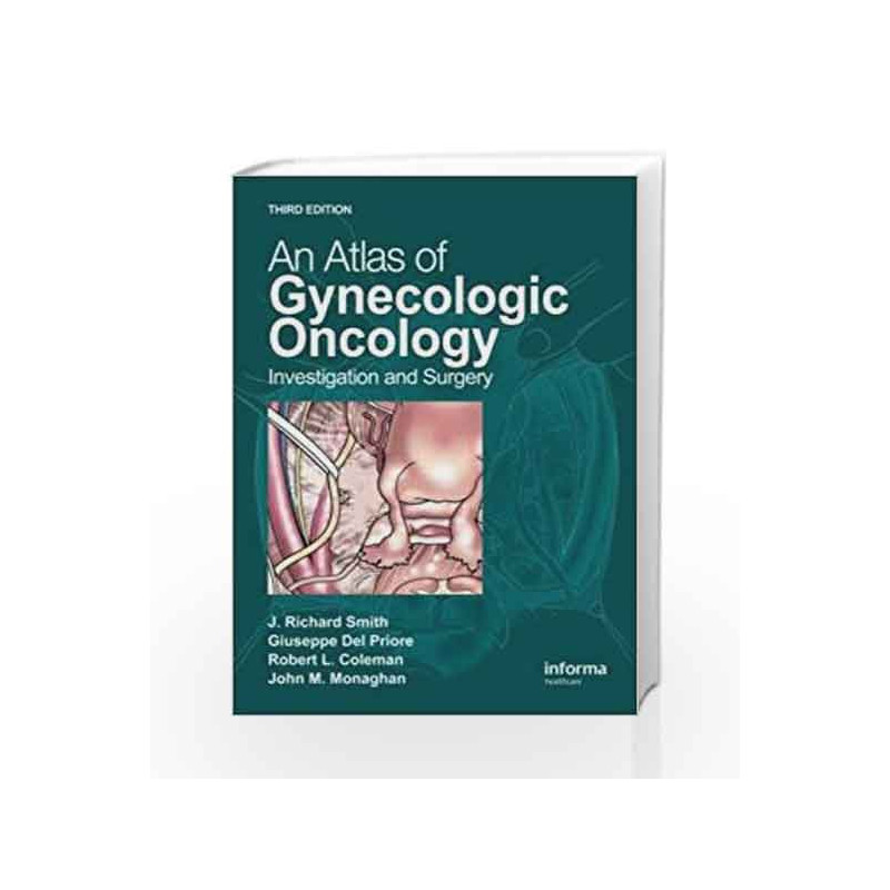 An Atlas of Gynecologic Oncology: Investigation and Surgery, Third Edition by Smith J.R. Book-9780415450591