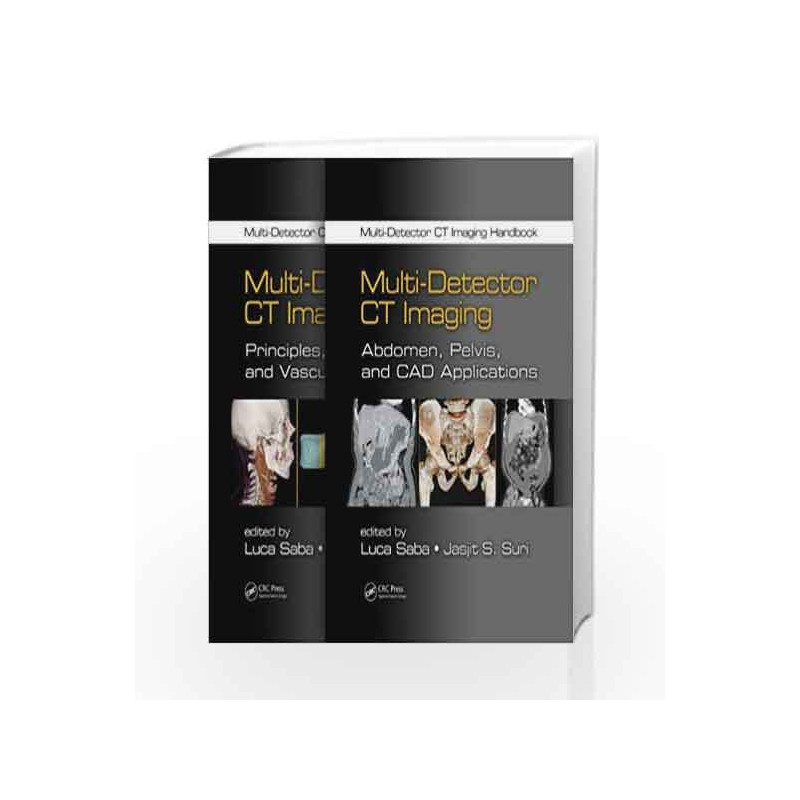 Multi-Detector CT Imaging Handbook, Two Volume Set by Saba Book-9781439893999