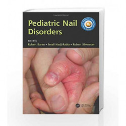 Pediatric Nail Disorders (Pediatric Diagnosis and Management) by Baran R. Book-9781498720458