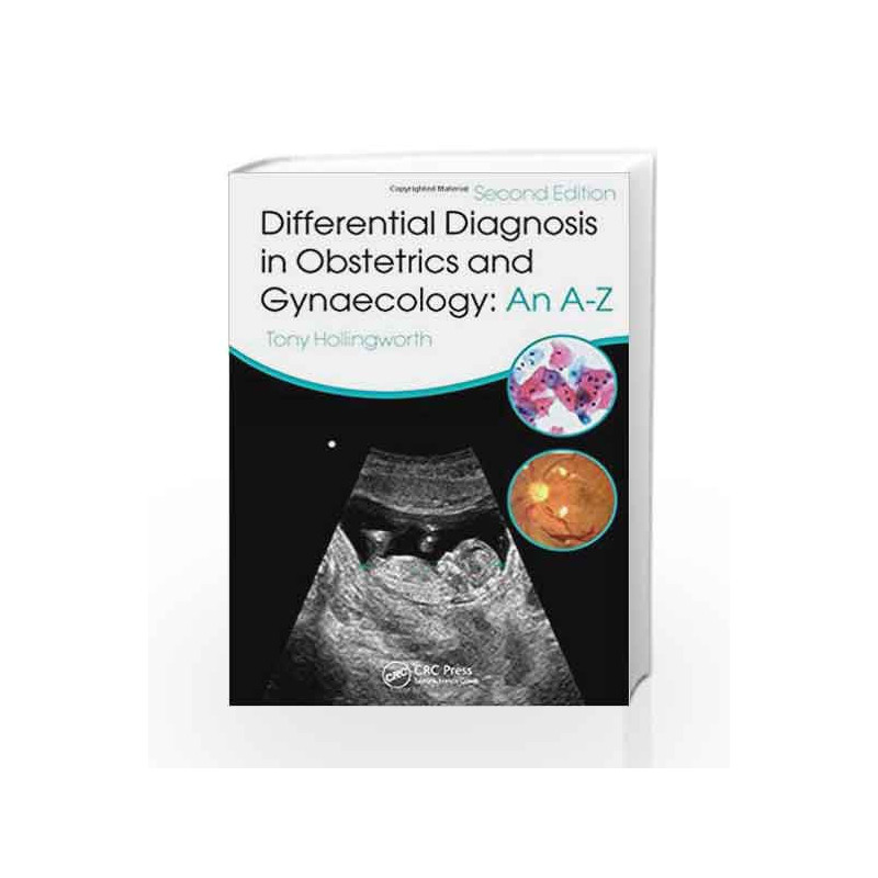 Differential Diagnosis in Obstetrics & Gynaecology: An A-Z, Second Edition by Hollingworth T Book-9781482215298