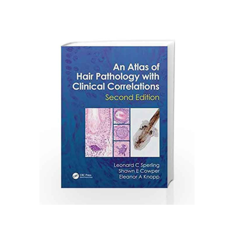 An Atlas of Hair Pathology with Clinical Correlations by Sperling L.C. Book-9781841847337