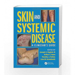 Skin and Systemic Disease: A Clinicians Guide by English J C Book-9781482221589