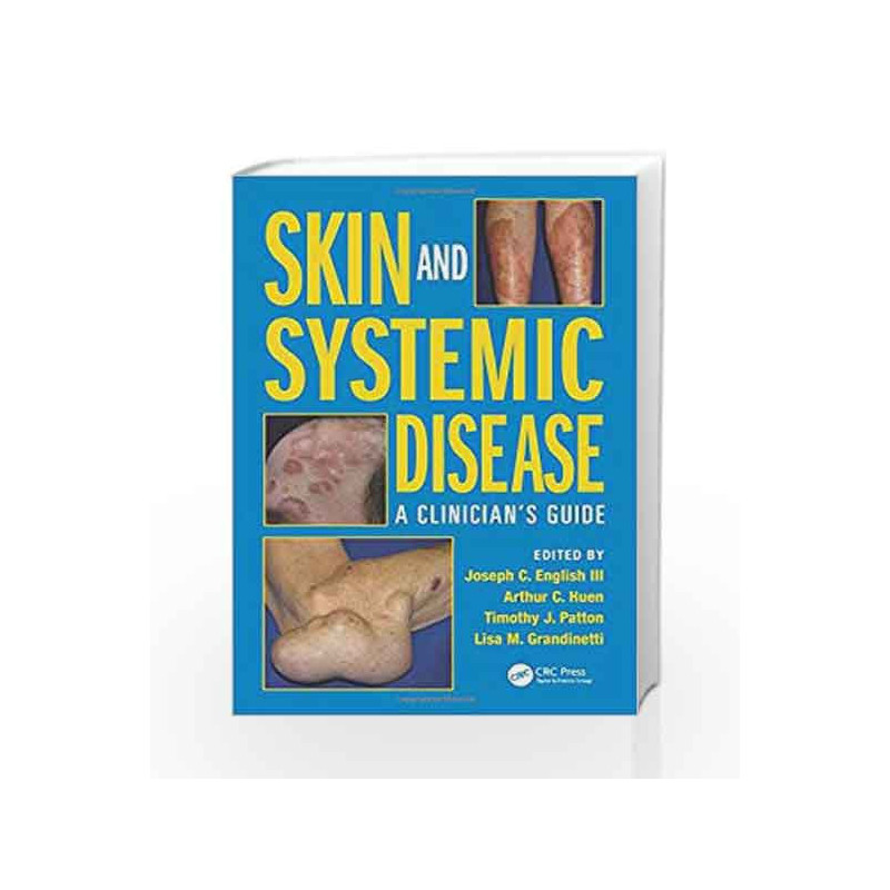 Skin and Systemic Disease: A Clinicians Guide by English J C Book-9781482221589