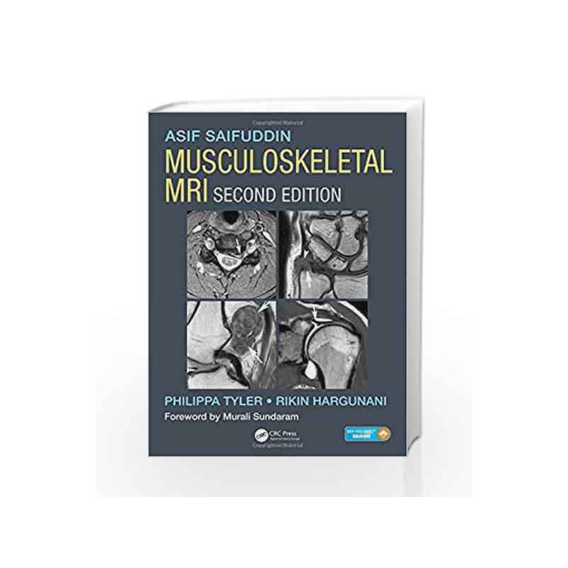 Musculoskeletal MRI by Saifuddin A Book-9781482247800
