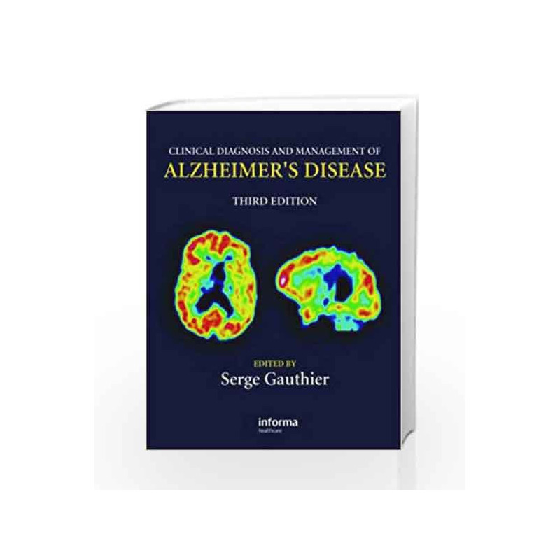 Clinical Diagnosis and Management of Alzheimer's Disease by Drennan Book-9780415372992