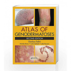 Atlas of Genodermatoses by Tadini G Book-9781466598355