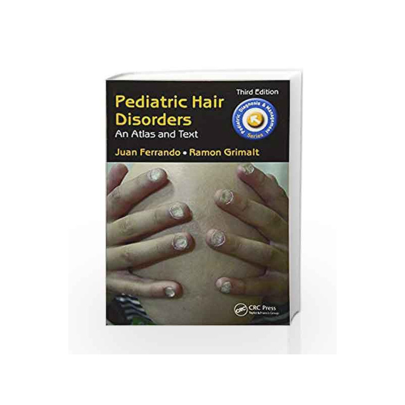 Pediatric Hair Disorders: An Atlas and Text, Third Edition (Pediatric Diagnosis and Management) by Ferrando J Book-9781498707770