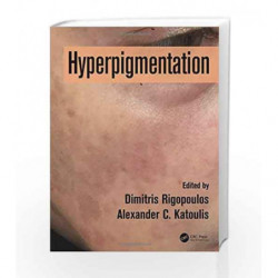 Hyperpigmentation by Rigopoulos D Book-9781498740173