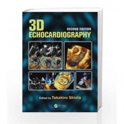3D Echocardiography by Shiota T Book-9781841849935
