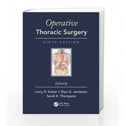 Operative Thoracic Surgery by Kaiser L.R. Book-9781482299571